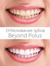 Отбеливание зубов Beyond Polus