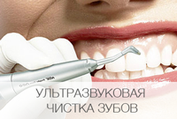 Удаление зубного камня ультразвуковым